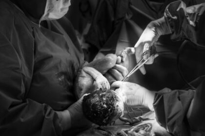 “An elective C-section is planned by request of the mother or due to medical indication, not as an emergency measure," said Dr. Shweta Mendiratta.(Pexels)