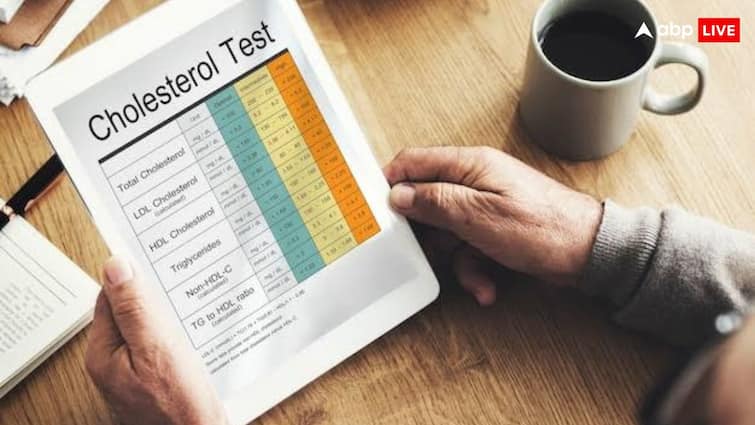 why good cholesterol is important for heart health how to increase HDL शरीर में क्या काम करता है गुड कोलेस्ट्रॉल, जान लीजिए ये आपके लिए कितना जरूरी