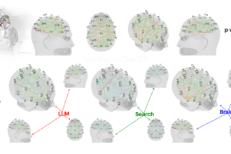 Brain on LLM